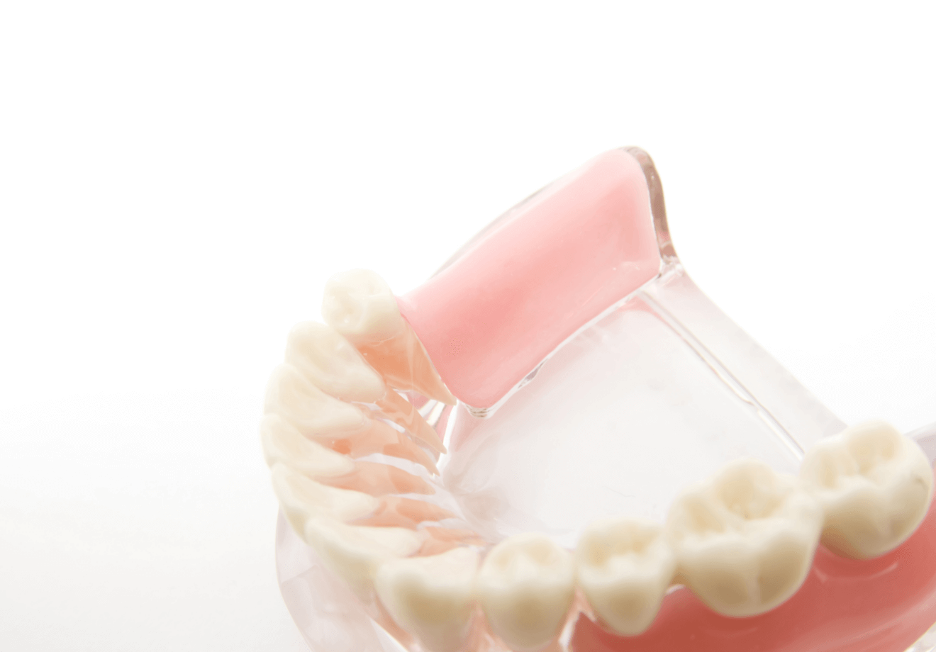 ニーズに合わせた豊富な入れ歯の種類